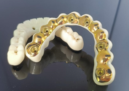 CAD/CAM Titanium Implant Bar+ ຂົວ Zirconia
