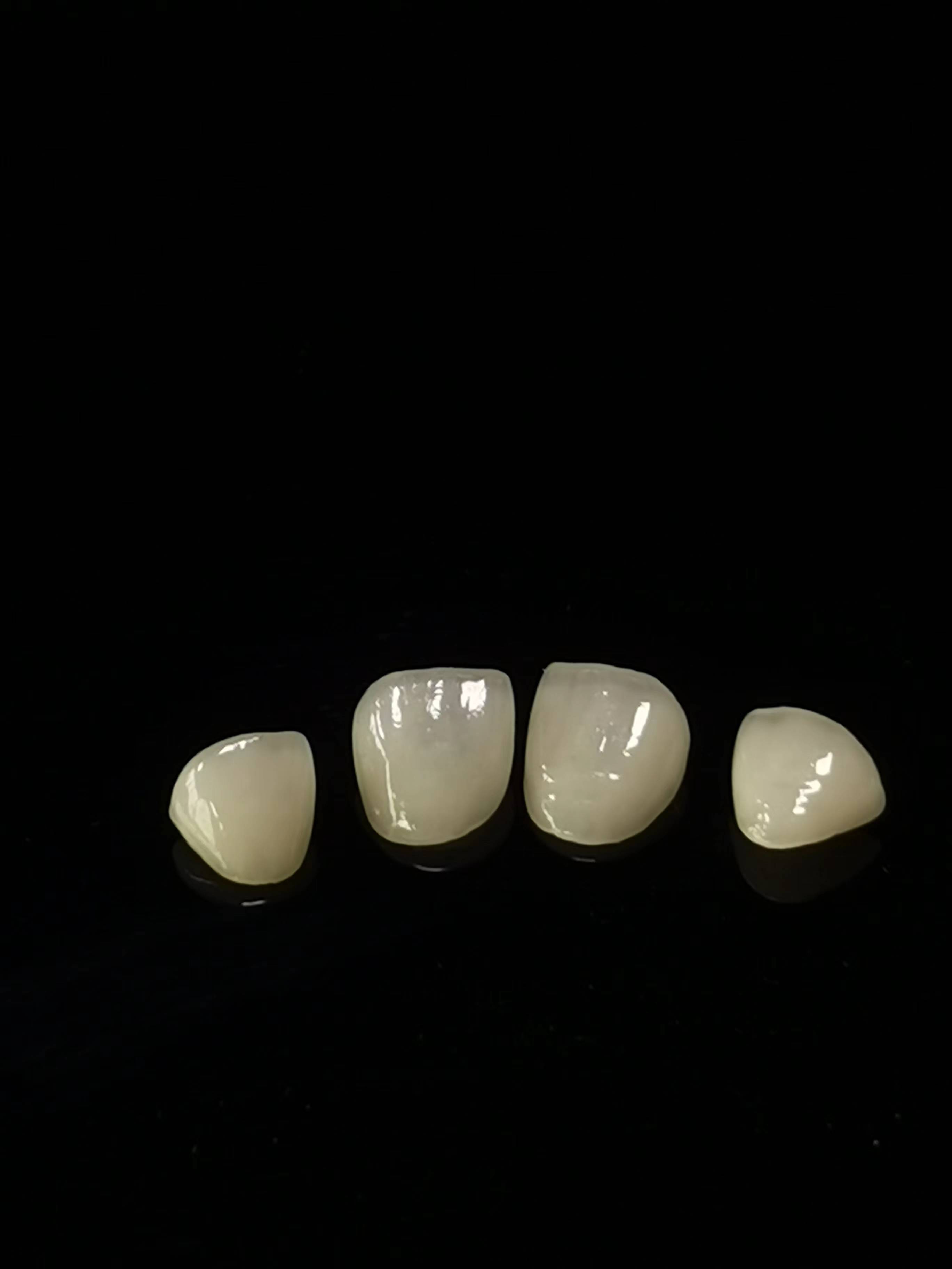 E.max Dental lab ເຮັດວຽກ