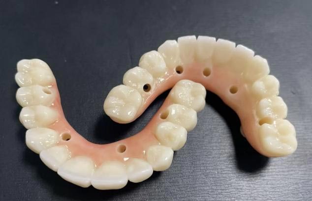 ເຊິ່ງດີກວ່າ: dentures ທີ່ເອົາອອກໄດ້ຫຼືແຂ້ວປອມທີ່ໄດ້ຮັບອອກ?
