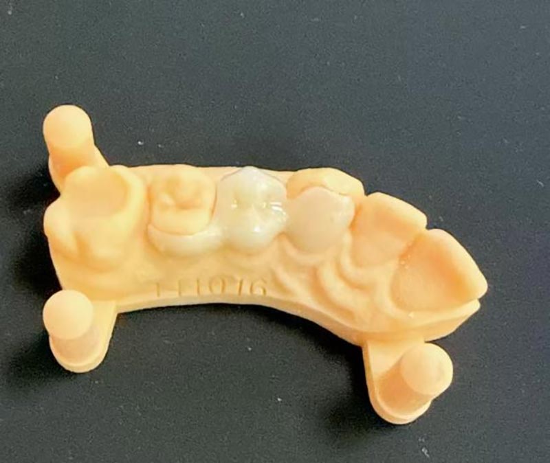 ສິ່ງທີ່ທ່ານຕ້ອງການຮູ້ກ່ຽວກັບ Maryland Bridges?