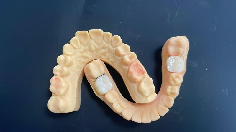 ຂອບບ່າແມ່ນຫຍັງ?