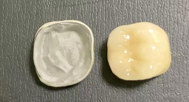 WM DENTAL LAB - ຫ້ອງທົດລອງທັນຕະກໍາຊັ້ນນໍາຂອງຈີນ