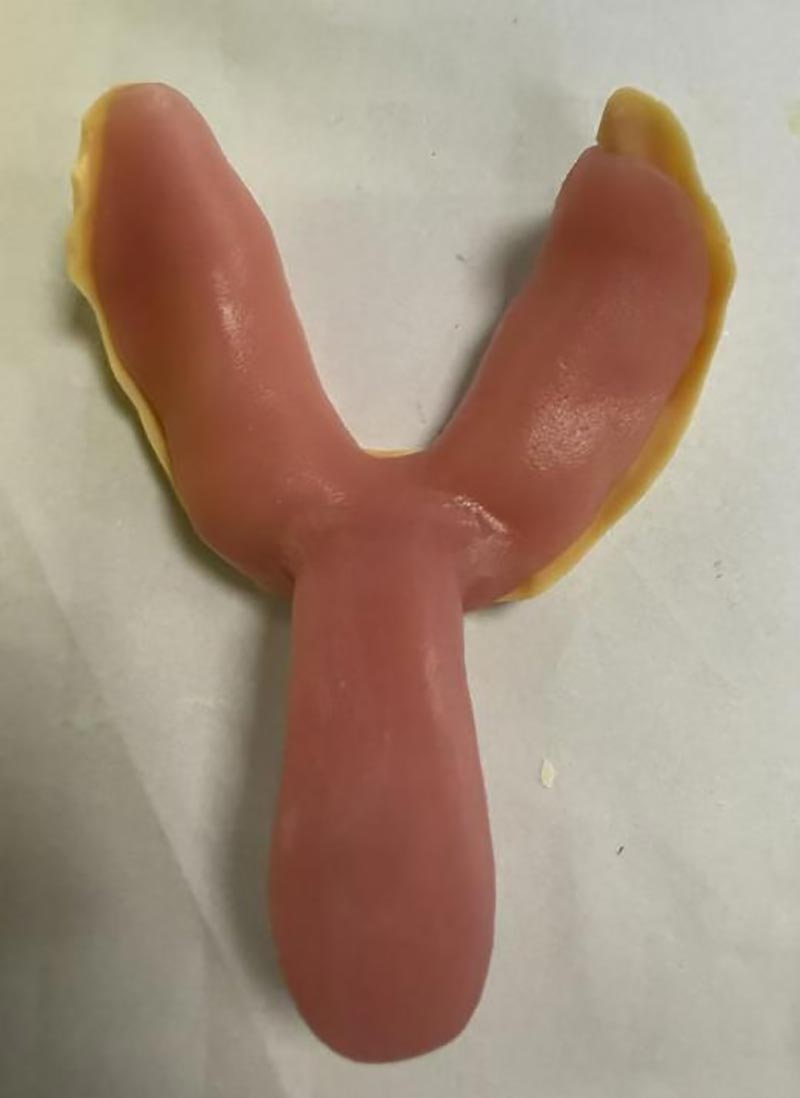 ສິ່ງທີ່ທ່ານບໍ່ຮູ້ກ່ຽວກັບຖາດແຂ້ວແບບກຳນົດເອງ