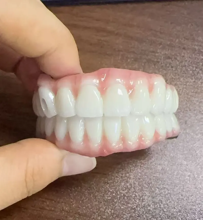 ອັນຕະລາຍຂອງ Malocclusion