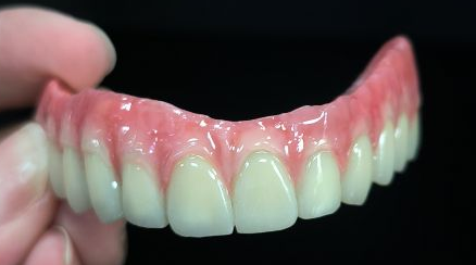 ທັງຫມົດໃນ 4 ປະສົມ - ຂົວ malo ເຕັມ zirconia ເຕັມຕໍາແຫນ່ງໃນໂຄງສ້າງ titanium