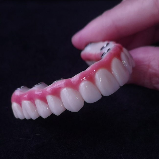 All On X Hybrid Bridge - Full Zirconia Bridge over Tibbases