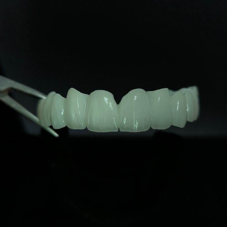 High Translucent Zirconia Bridge Layered Zirconia China Dental Lab work