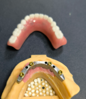 ສະຖານທີ່ຕັ້ງແລະແຖບແຂ້ວ