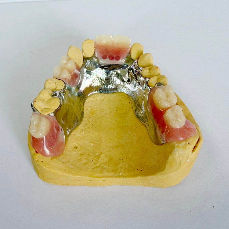 ກອບສ່ວນການຟື້ນຟູທີ່ຖອດອອກໄດ້